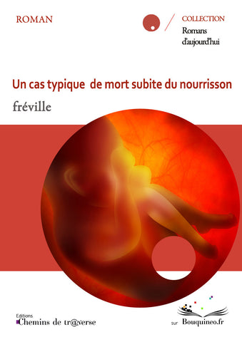 A typical case of sudden infant death syndrome - Fréville